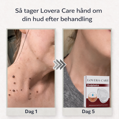 Lovera Care – Hudplastre