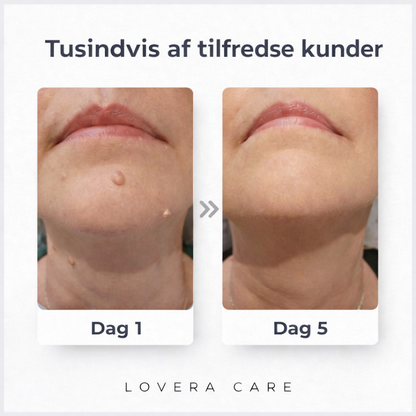 Lovera Care – Hudplastre